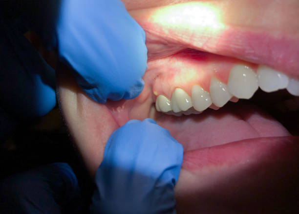 Best Emergency Dental Care for Trauma or Injury in Lockwood, MO
